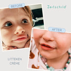 Litteken crème