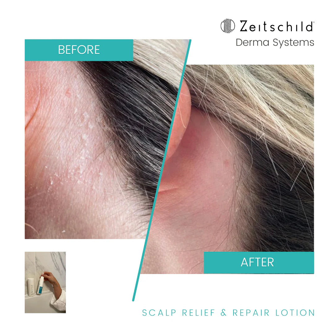 Scalp Relief & Repair lotion